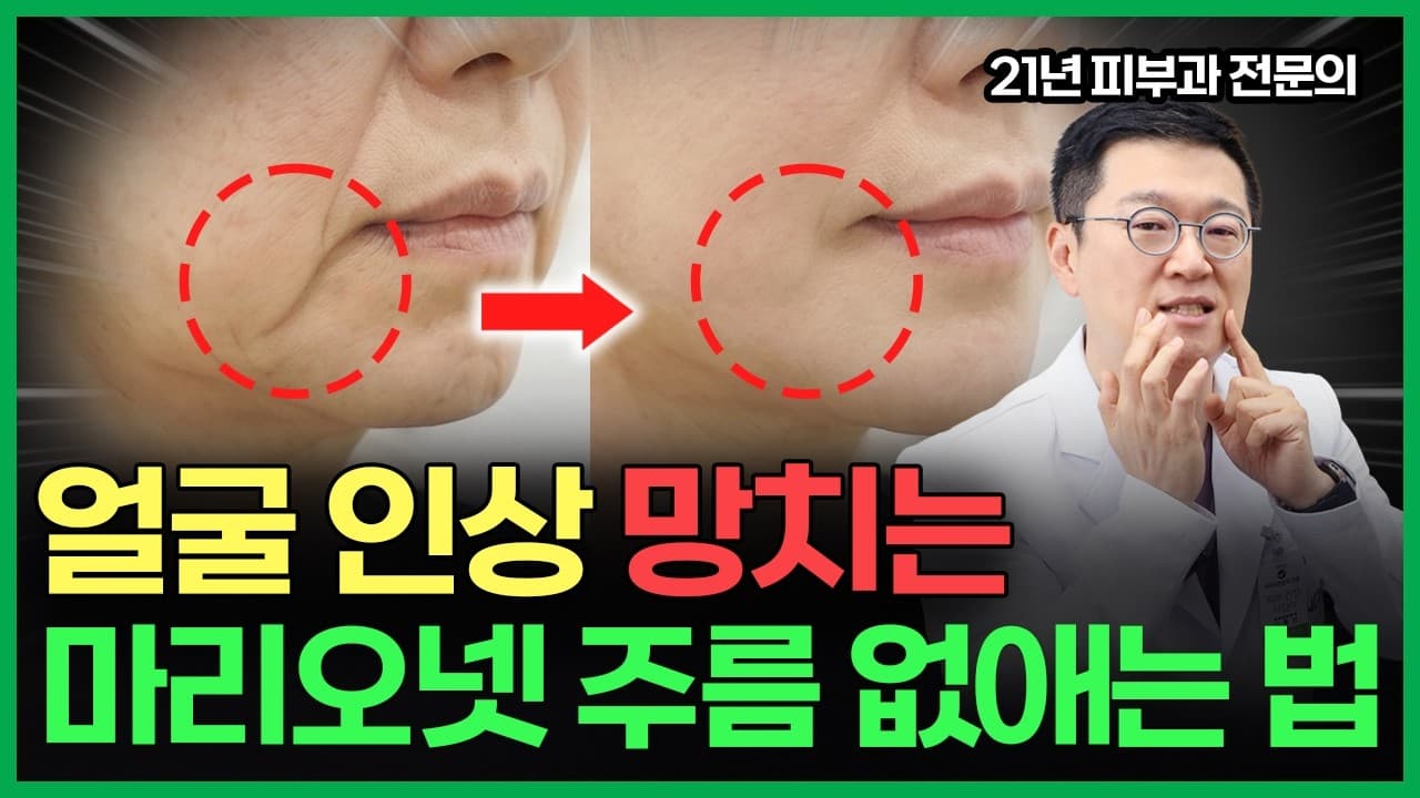 "나이들어보이는 입가주름" 수술없이 마리오넷주름 간단하게 해결하세요 | 마리오넷주름, 마리오넷주름해결방법, 울쎄라