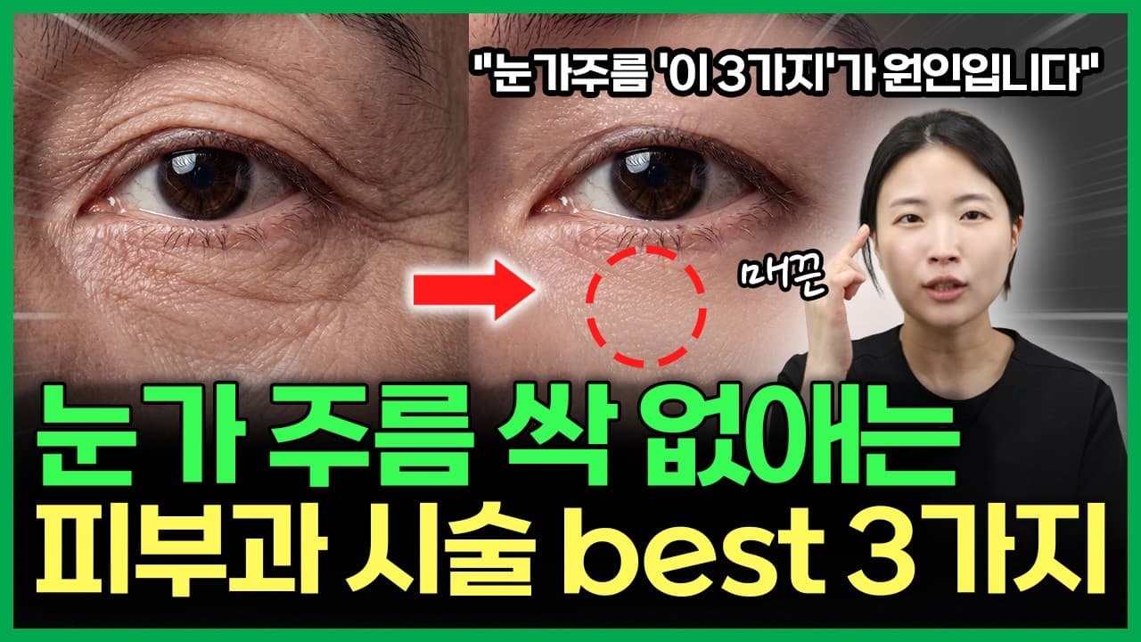 자글자글한 눈가, 아이크림으로 안 되는 눈가주름 없애는법 피부과 전문의가 알려드립니다 | 눈가주름, 얼굴주름, 눈가주름없애는법